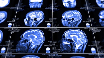 magnetic resonance imaging 2021-10 blue-2